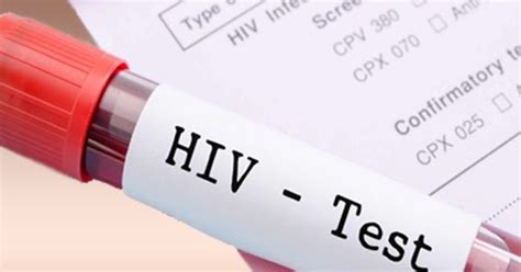 las pinas social hygiene clinic|List of HIV Testing Centers in Metro Manila (NCR).